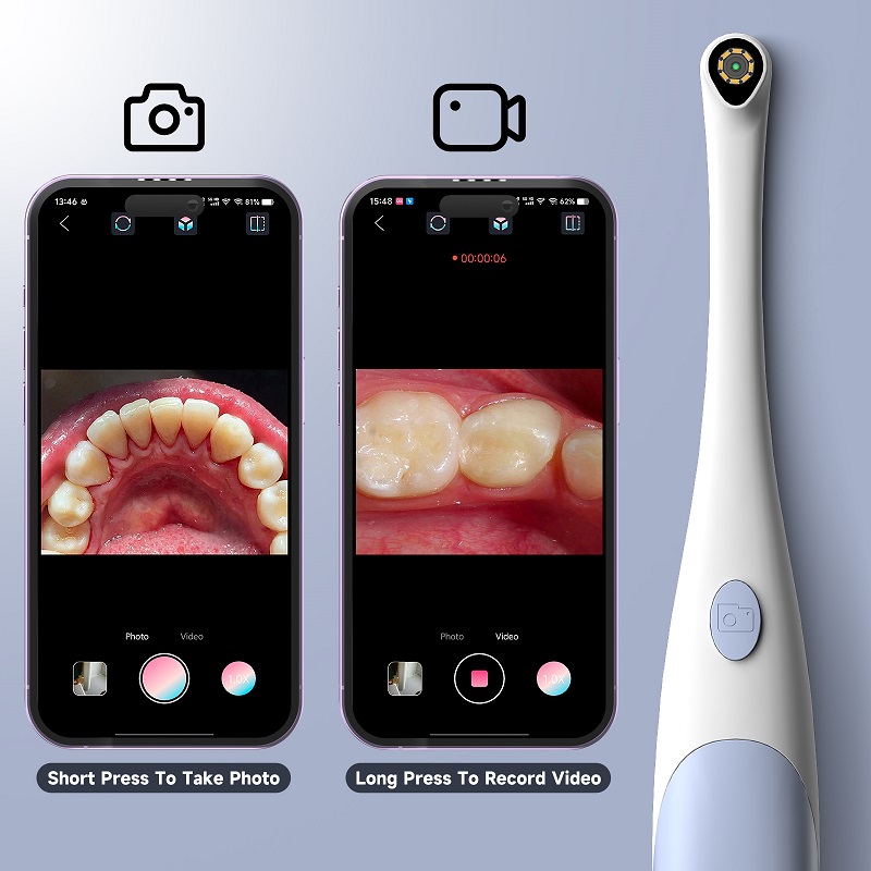 iPhone için TYPE-C Görsel Oral - Endoscope Inspection Camera incelemesi ve fiyatı